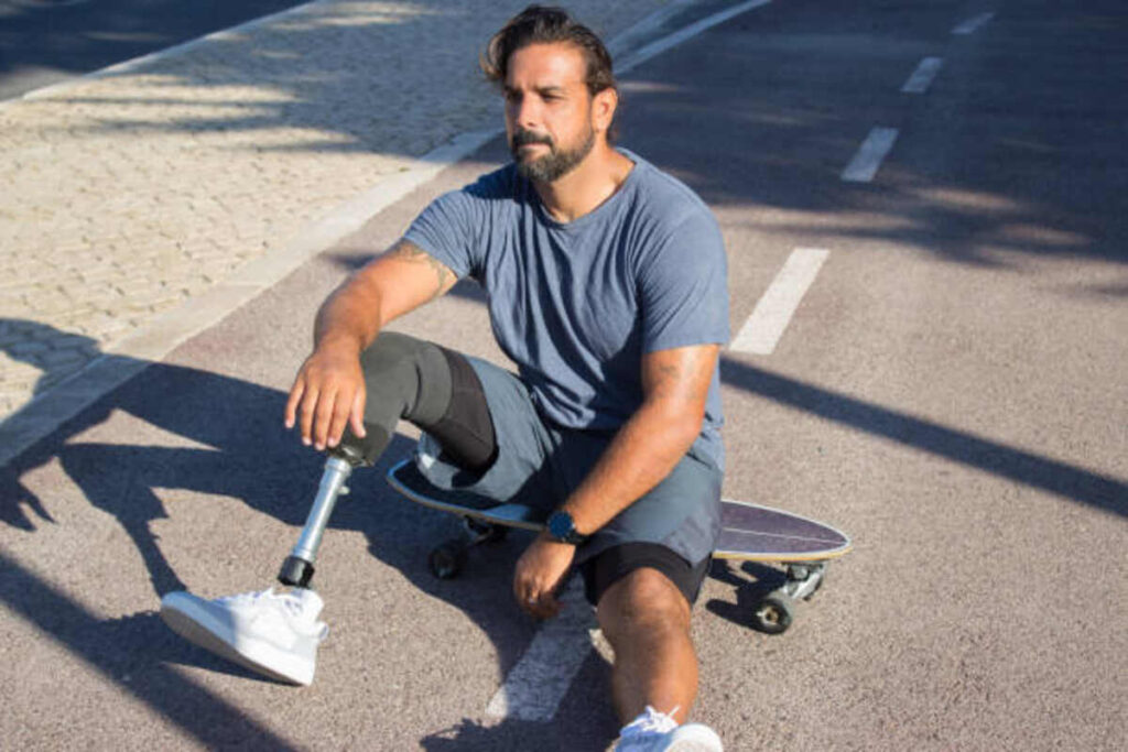 Choosing the Right Knee Scooter for Recovery